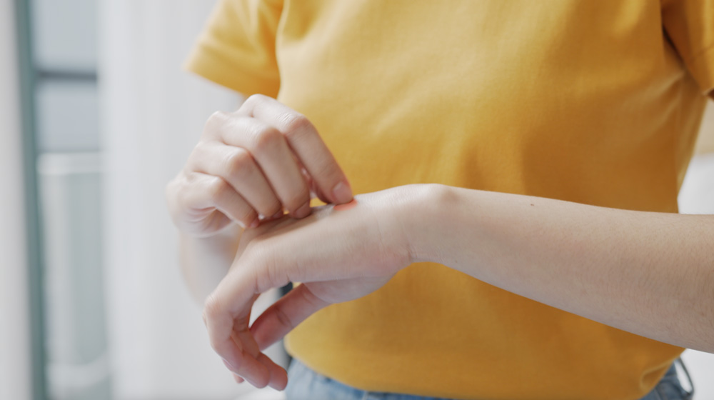 Exploring the Itch: Understanding Why Bug Bites Itch, and what we can do