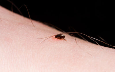 Protecting Your Pets from Fleas, Ticks, and Other Parasites